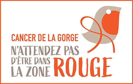 cancer de la gorge