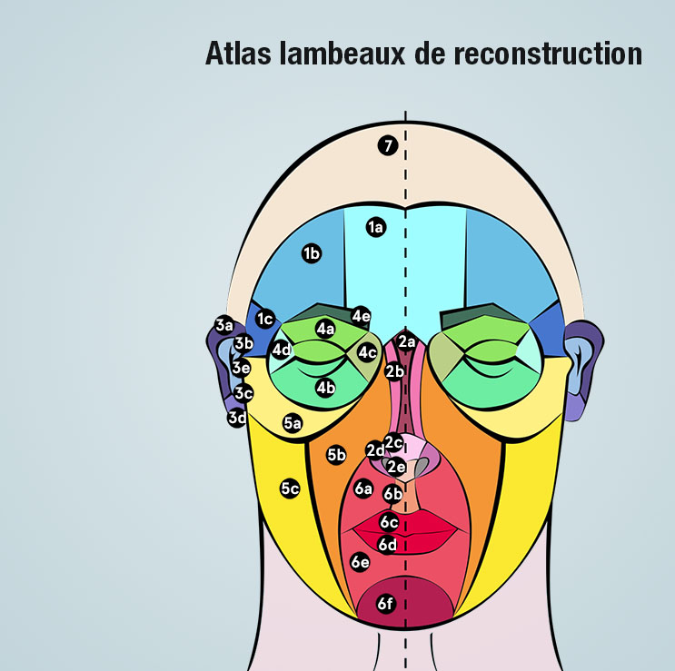 lambeaux de reconstruction