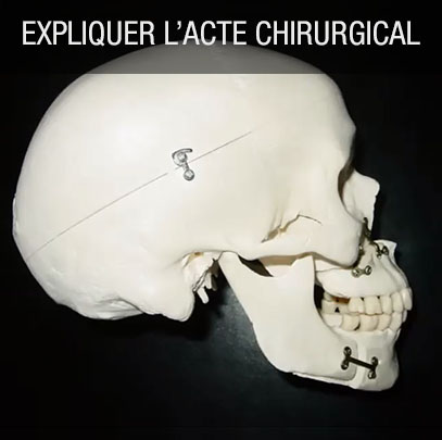 acte chirurgical orthognathique