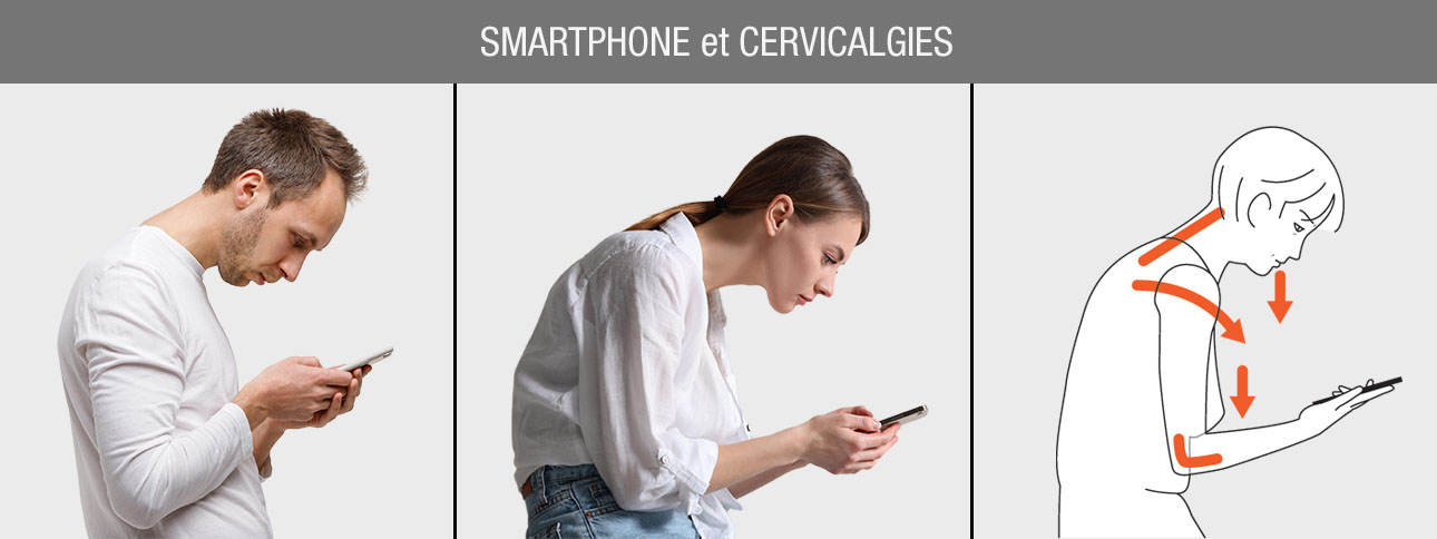 cervicalgie