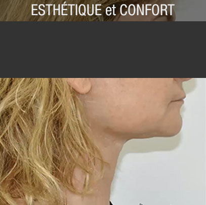 chirurgie esthétique et amélioration du confort