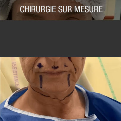 chirurgie esthétique sur mesure demande es patients