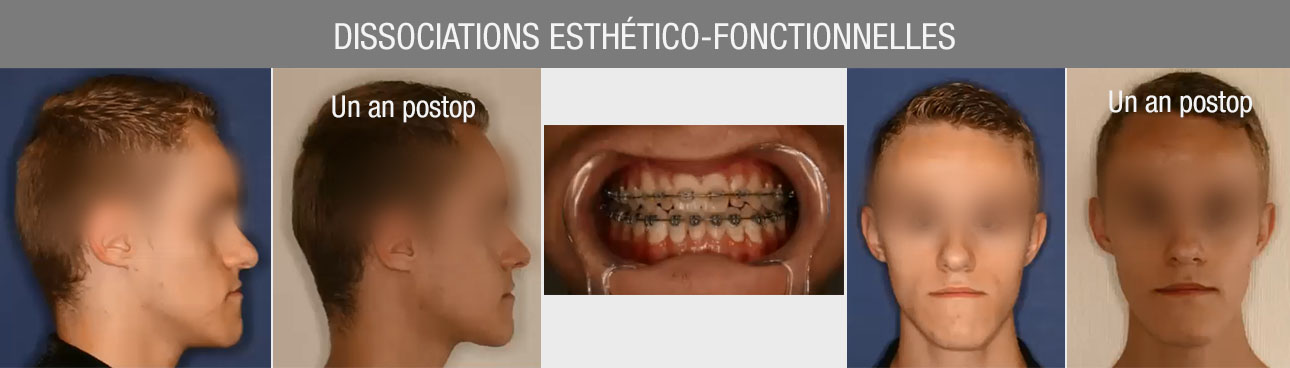 dissociations esthético fonctionnelles