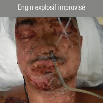 engin explosif improvisé