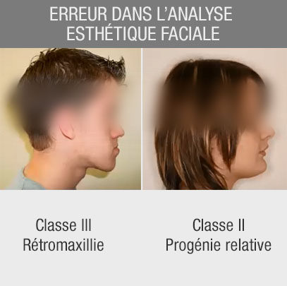 Erreur dans l'analyse esthétique faciale