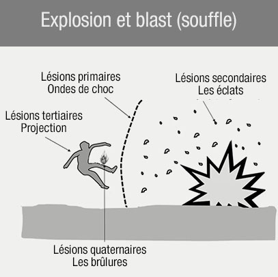explosion et souffle