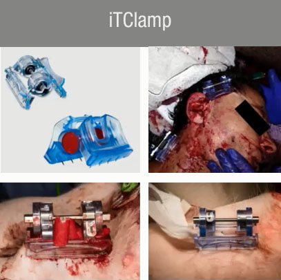 ITClamp