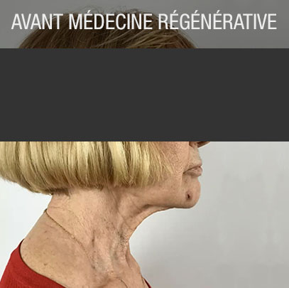 Cas clinique médecine régénérative