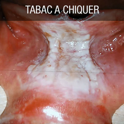 Tabac à chiquer