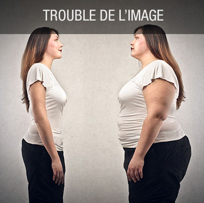 Trouble de l'image corporelle dysmorphie corporelle
