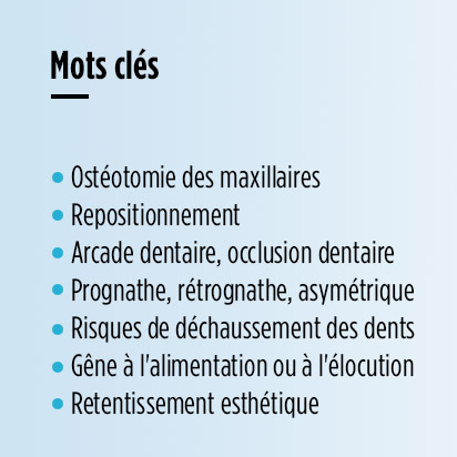 ostéotomie des maxillaires