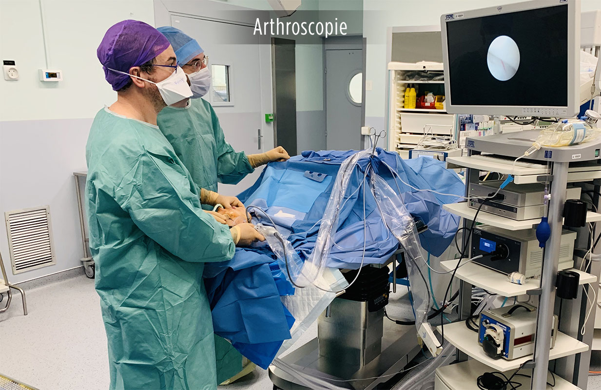 arthroscopie