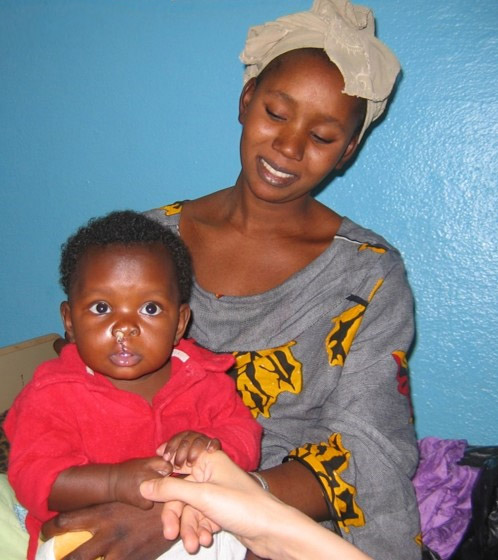 chirurgie humanitaire