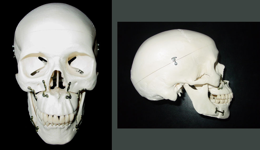 dysmorphies maxillomandibulaires