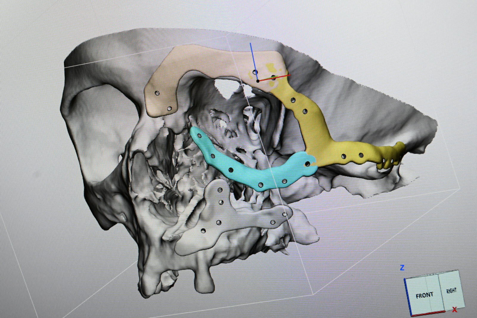 modelisation scanner