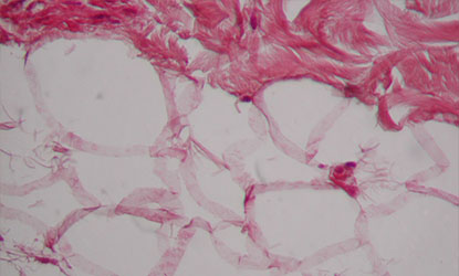 peau humaine hypoderme