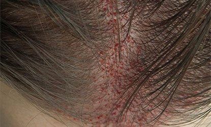 repousse naturelle de cheveux