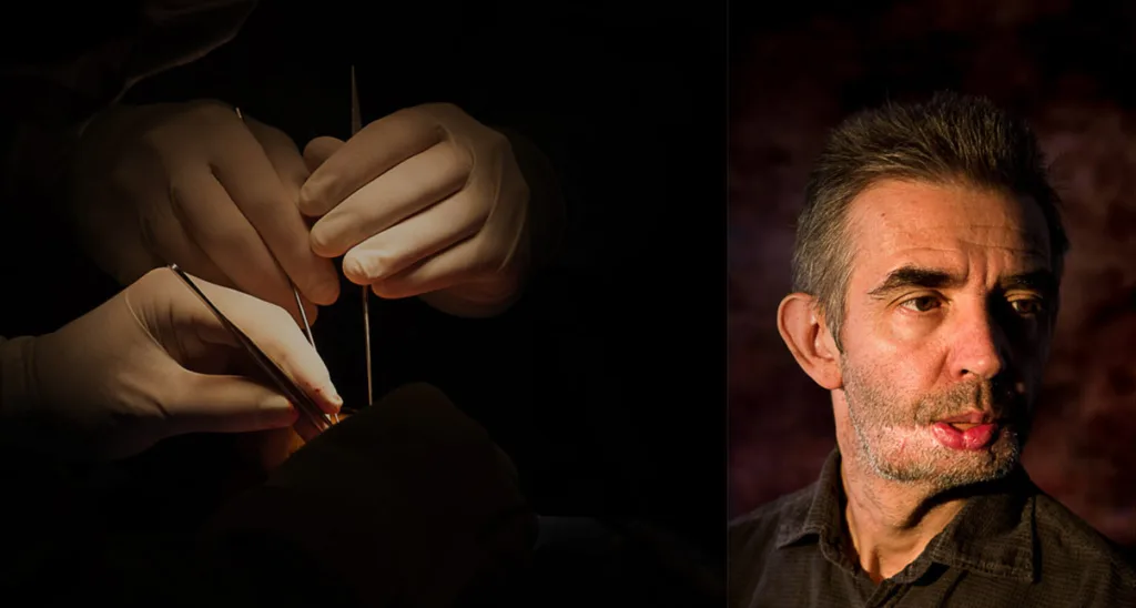 chirurgie du visage