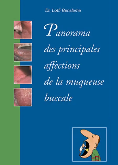 Dermatologie buccale : panorama des principales affections