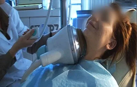 Pathologie salivaire - Utilisation du laser diode en sialendoscopie pour la fragmentation des lithiases